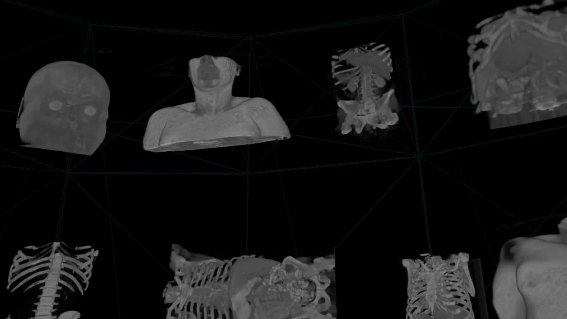 media 155555 thumbnail image
