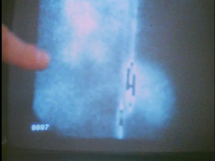 media 156031 thumbnail image