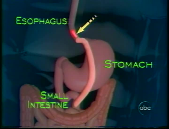 media 157353 thumbnail image