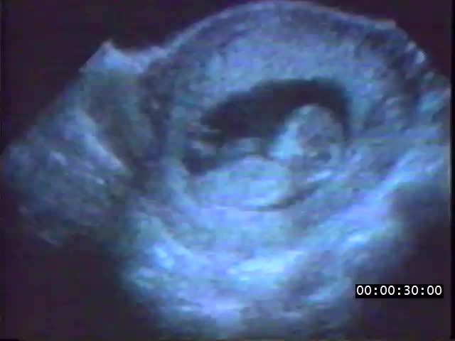 media 223242 thumbnail image