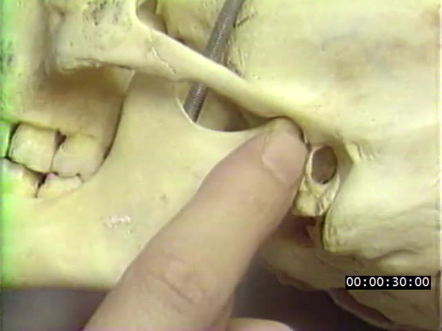 media 223522 thumbnail image