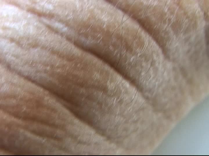 media thumbnail